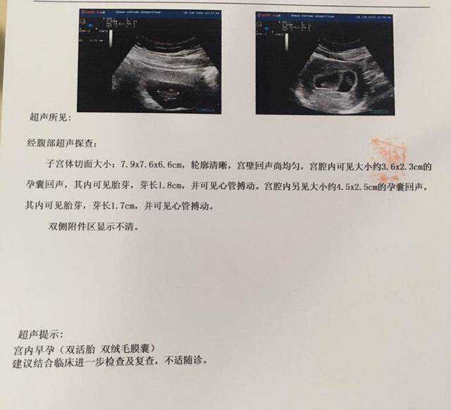 <b>广州单身可以代孕么，广州生产避孕套厂家</b>