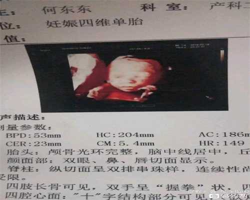 广东代生孩子费用是多少,广东妇幼保健院三代试管费用是多少钱？