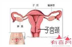 广州供卵助孕试管婴儿，从广州去泰国，广州试管婴儿助孕机构选择攻略
