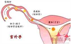 广州代孕生孩子机构，广州妇科哪家好_广州治疗内分泌不孕的医院