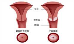 广州供卵试管包生吗，广州试管婴儿成功几率高吗？