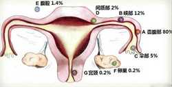 广州助孕试管生子，广州治疗输卵管堵塞贵吗_广州不孕不育医院哪家好