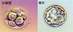广州代孕的代价，70后广州三代试管婴儿，27天顺利“好孕”