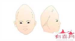 广州代孕生子要多少钱，广州输卵管通而不畅治疗需多少钱